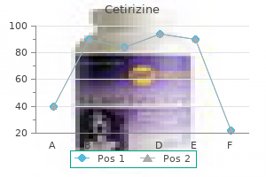 cetirizine 10 mg mastercard