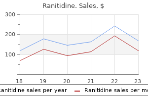 order ranitidine 150 mg online