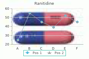 300 mg ranitidine order mastercard