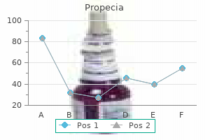 trusted 1 mg propecia