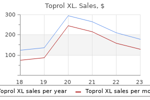 buy cheap toprol xl on-line