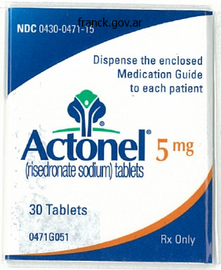 actonel 35 mg purchase with visa