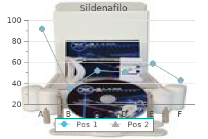 discount sildenafilo 100 mg buy line