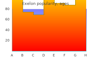 order 3 mg exelon fast delivery
