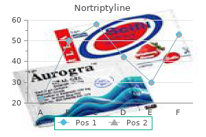 nortriptyline 25 mg purchase amex