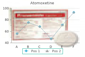 atomoxetine 18 mg buy overnight delivery