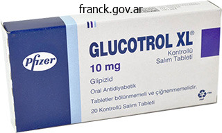 glucotrol xl 10 mg low price