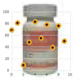 Membranoproliferative glomerulonephritis (type II)