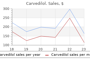 order genuine carvedilol line