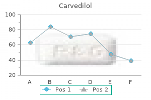 buy carvedilol cheap online