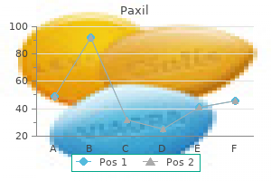 discount 30mg paxil free shipping