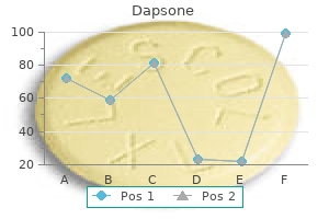 buy dapsone 100 mg online