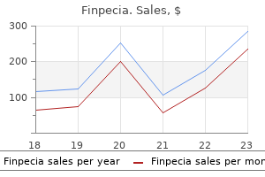 finpecia 1mg with visa