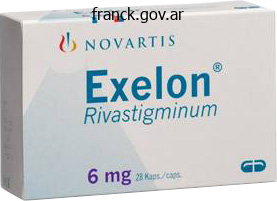 buy rivastigimine 4.5 mg free shipping