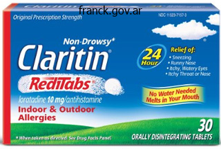 discount claritin 10 mg free shipping