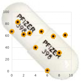 Hydrocephaly low insertion umbilicus
