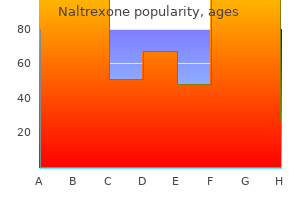 discount naltrexone 50mg fast delivery