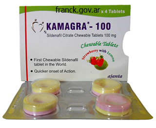 buy kamagra polo on line amex