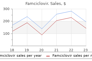 cheap 250 mg famciclovir with visa
