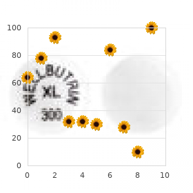 Carnitine palmitoyltransferase II deficiency