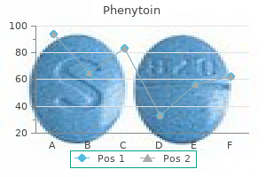 100 mg phenytoin mastercard